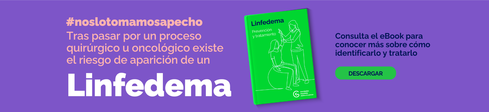 E-book Linfedema. Prevención y tratamiento